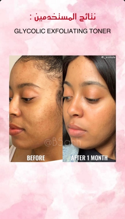 Good molecules, GLYCOLIC EXFOLIATING TONER  جود موليكيولز، تونر حمض الجليكوليك للتقشير 